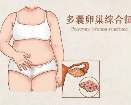 捐卵怎么生[广州助孕选aa69助孕],北京可以做试管婴儿移植术的医院