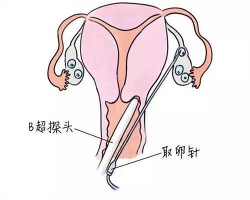 三代试管代孕可以选择性别吗_有人工代孕成功的么_有没有正规的代孕机构