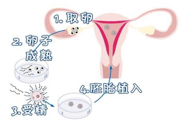 安康借卵代怀_泰国试管婴儿7个步骤流程的详细介绍